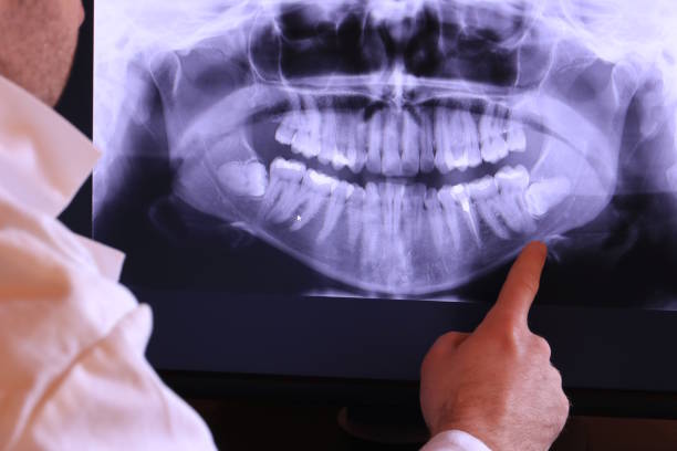 Best Emergency Root Canal Treatment in Paw Paw, MI